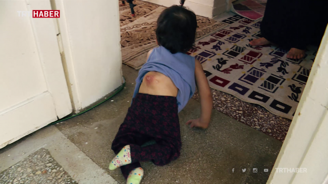 Küçük Melek sağlığına kavuşmak için yardım bekliyor